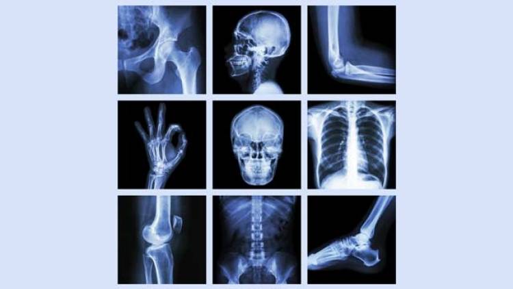Bildgebende Verfahren: Wie funktioniert Röntgen?