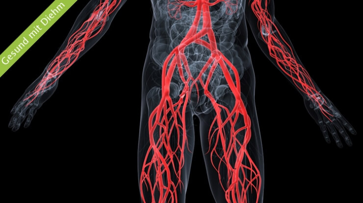 Arterielle Verschlusskrankheit (PAVK) frühzeitig erkennen