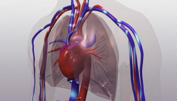 Lebensbedrohliche Unbekannte: Herzerkrankung Aortenstenose