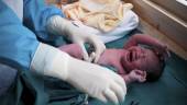 Kaiserschnitt: Wie oft wird er eingesetzt?