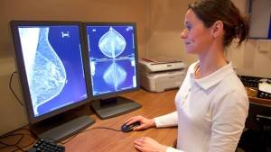 Brustkrebs - Bewebungsmangel und Hormone sind größte Risikofaktoren