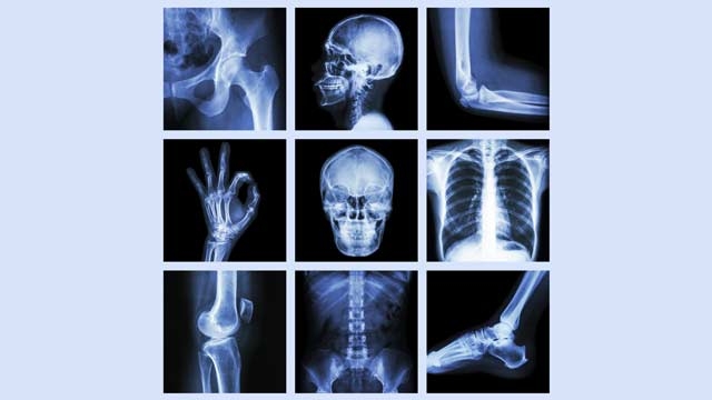 thinkstockphotos.com