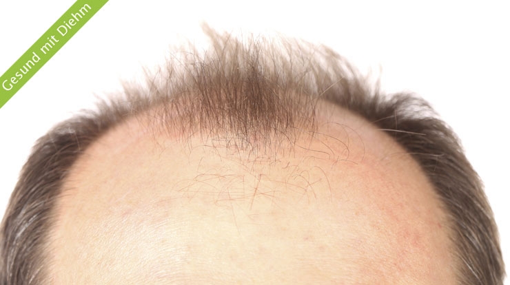 thinkstockphotos.com